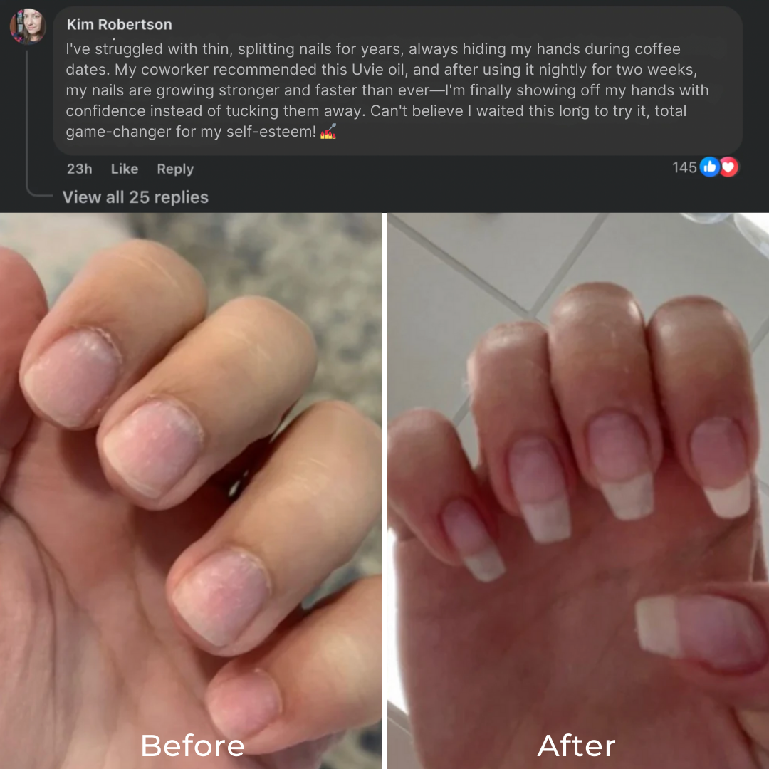 Stem Cells Nail Growth Pen