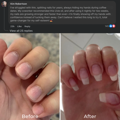 Stem Cells Nail Growth Pen