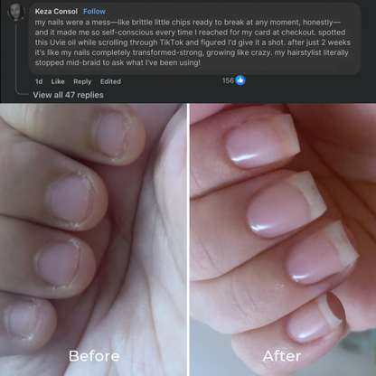 Stem Cells Nail Growth Pen