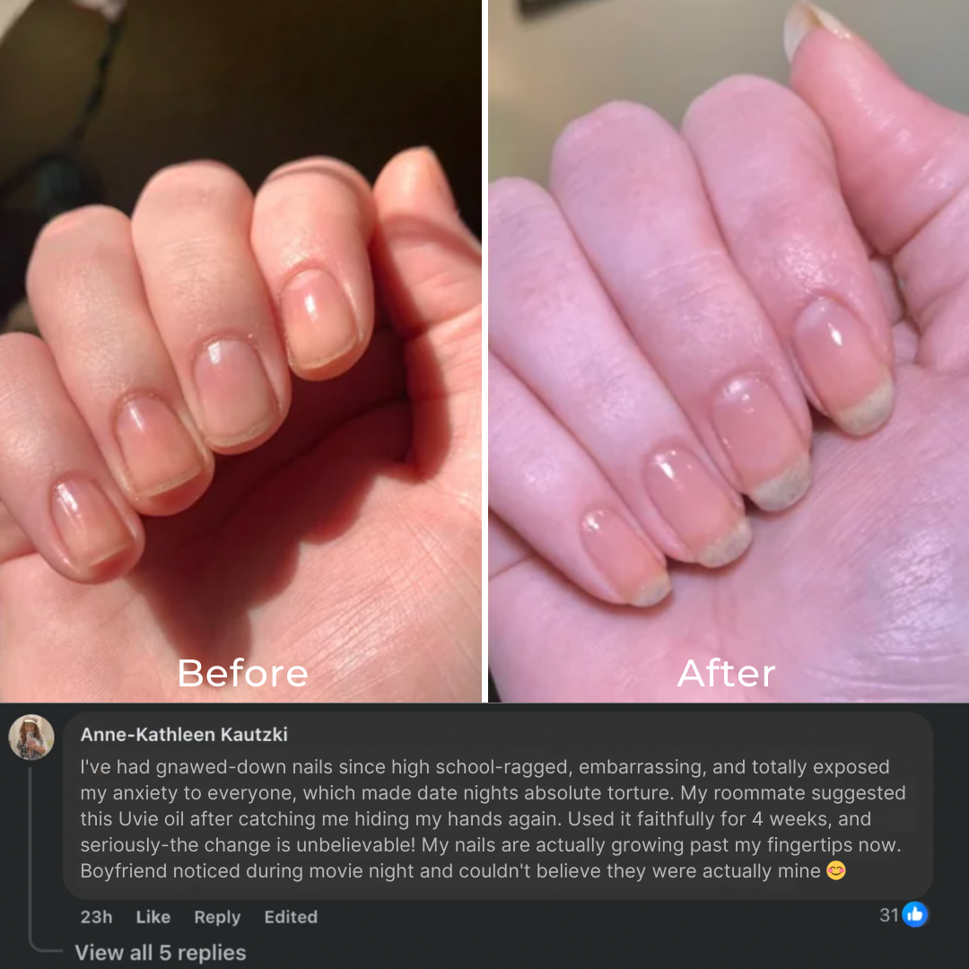 Stem Cells Nail Growth Pen