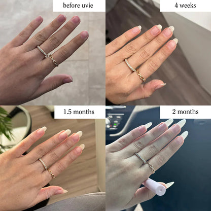 Stem Cells Nail Growth Pen